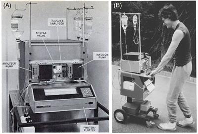 Frontiers Closed Loop Insulin Delivery Systems Past Present